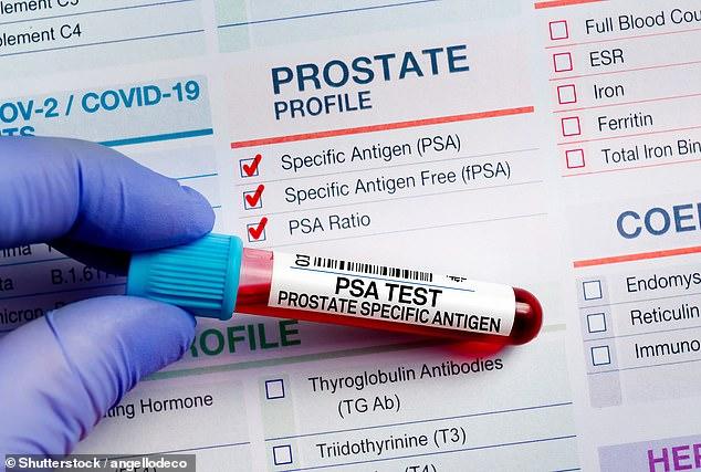 Prostate cancer cases hit record high: More than 60,000 men diagnosed in a year for the first time as rates jump 7 per cent