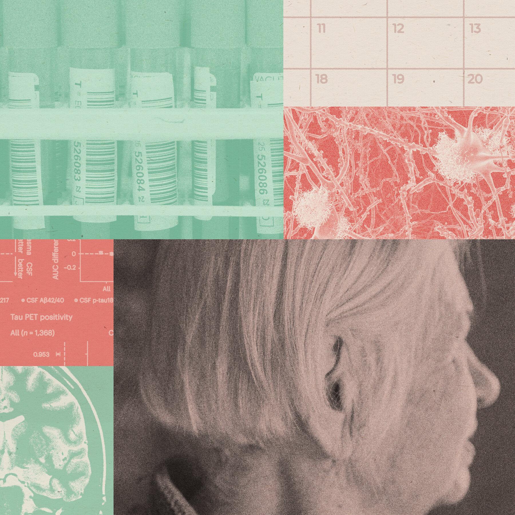 Alzheimer’s Blood Tests Offer New Promise to Diagnose and Predict the Disease